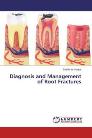 Livro Diagnosis and Management of Root Fractures Shehla W. Haque