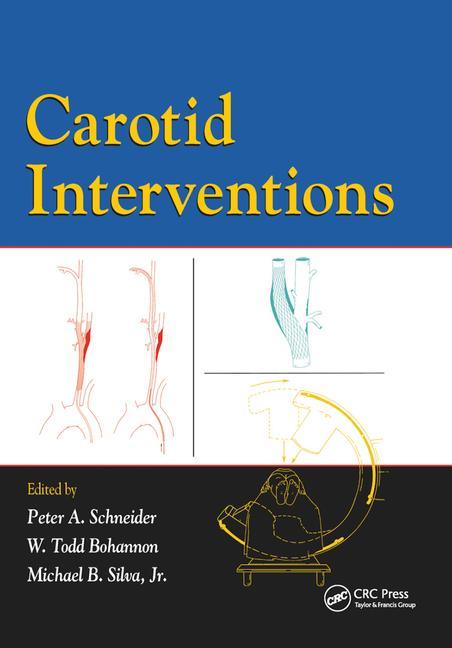Carte Carotid Interventions Peter Schneider
