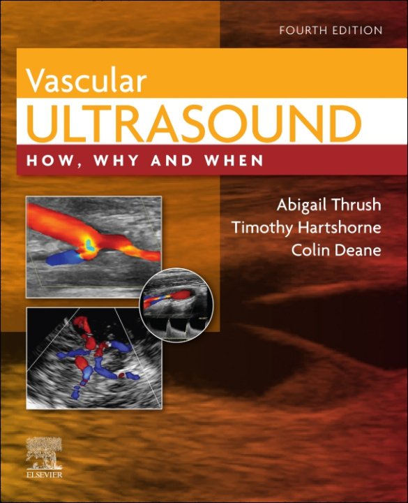 Könyv Vascular Ultrasound 