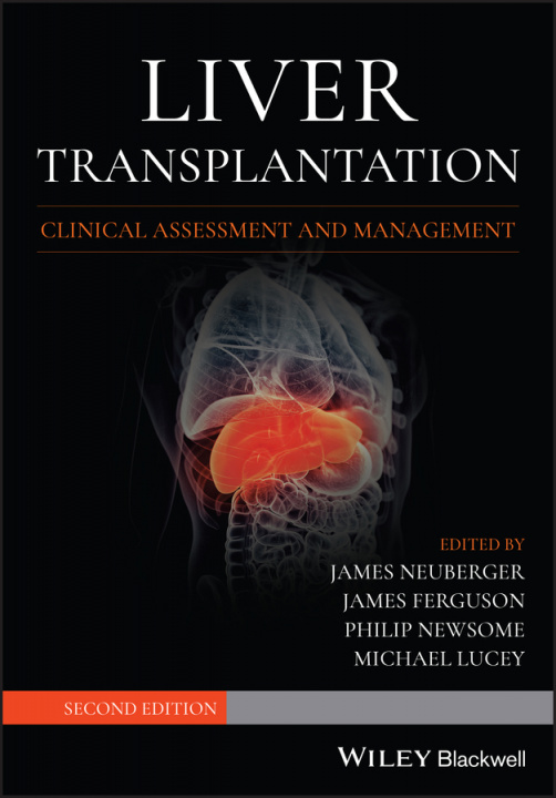 Book Liver Transplantation - Clinical Assessment and Management, 2nd edition Michael R. Lucey
