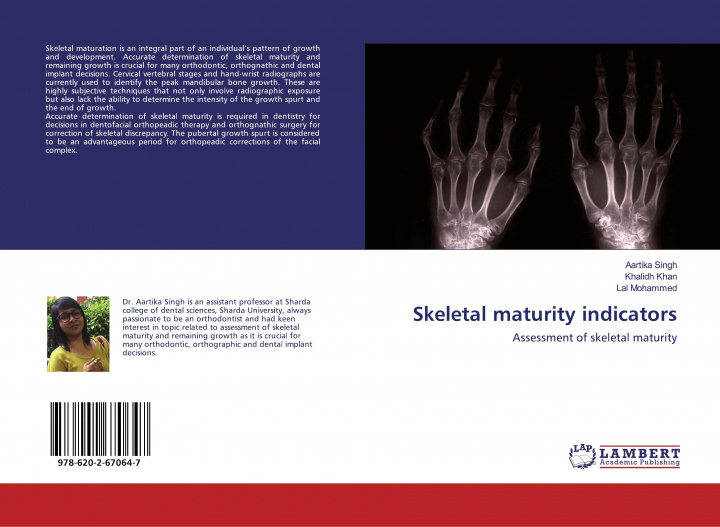 Knjiga Skeletal maturity indicators Khalidh Khan