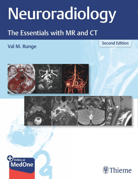 Kniha Neuroradiology 