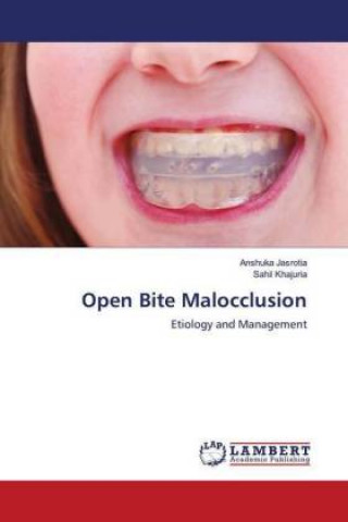 Knjiga Open Bite Malocclusion Sahil Khajuria