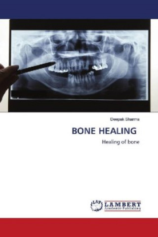 Buch BONE HEALING Deepak Sharma