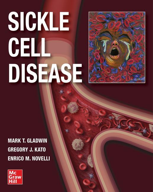 Boek Sickle Cell Disease Kato