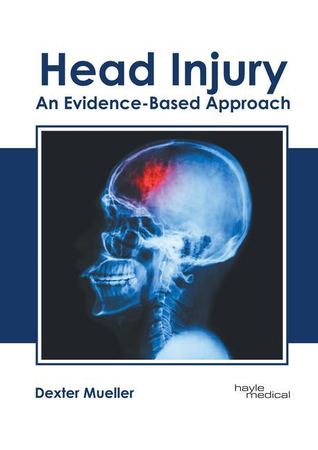 Könyv Head Injury: An Evidence-Based Approach 
