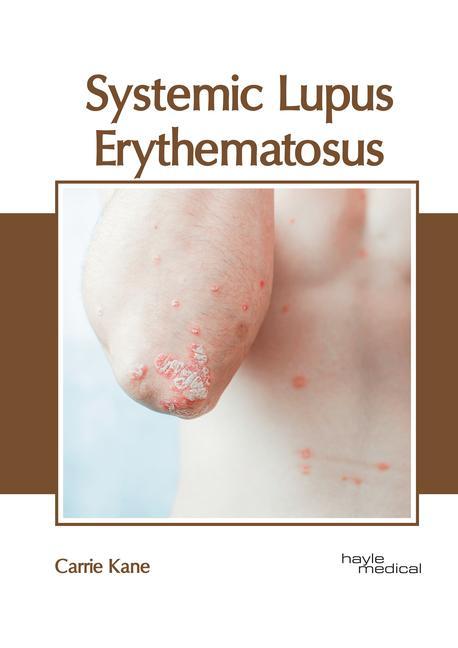 Kniha Systemic Lupus Erythematosus 