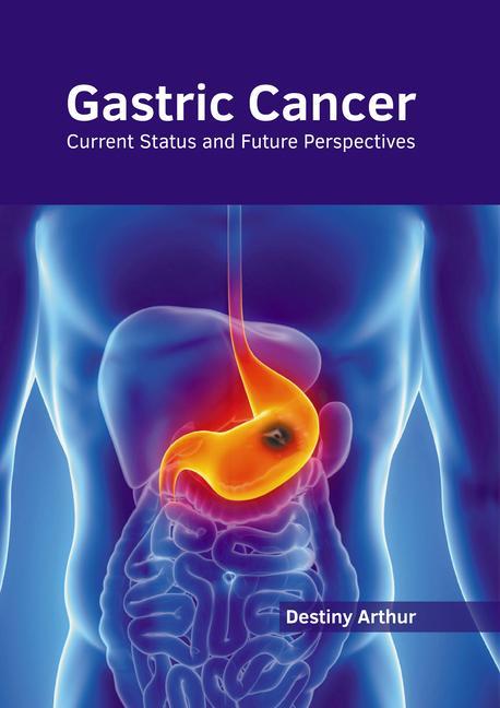 Könyv Gastric Cancer: Current Status and Future Perspectives 