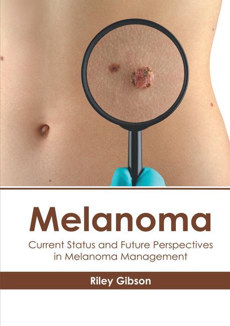 Carte Melanoma: Current Status and Future Perspectives in Melanoma Management 