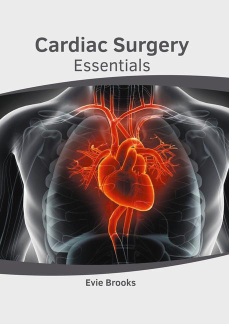 Knjiga Cardiac Surgery Essentials 