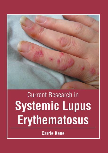 Könyv Current Research in Systemic Lupus Erythematosus 