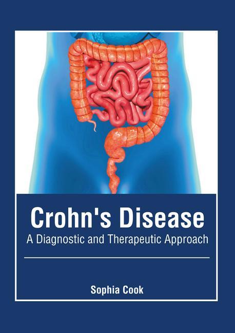 Kniha Crohn's Disease: A Diagnostic and Therapeutic Approach 