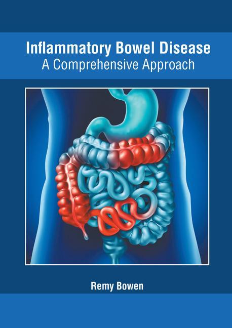 Könyv Inflammatory Bowel Disease: A Comprehensive Approach 