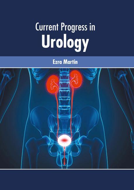 Knjiga Current Progress in Urology Ezra Martin