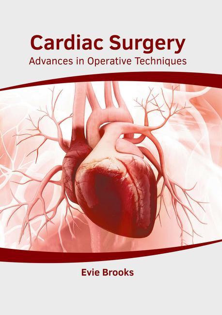 Kniha Cardiac Surgery: Advances in Operative Techniques 
