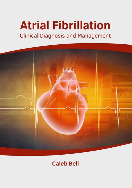 Kniha Atrial Fibrillation: Clinical Diagnosis and Management 