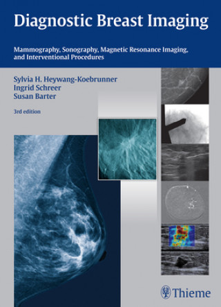 Kniha Diagnostic Breast Imaging Sylvia H. Heywang-Koebrunner