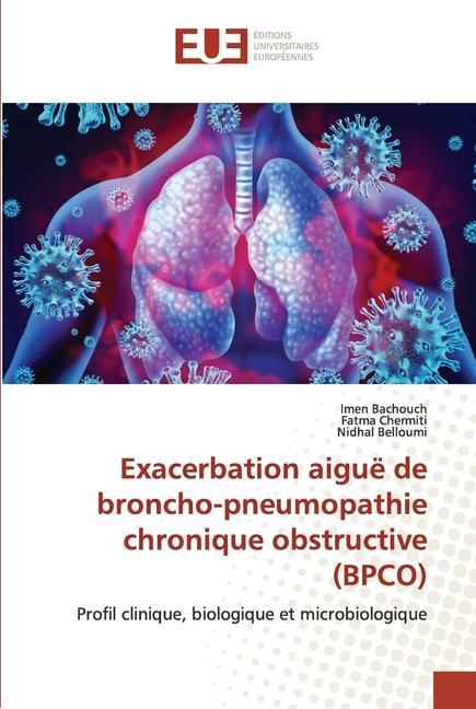 Kniha Exacerbation aigue de broncho-pneumopathie chronique obstructive (BPCO) Fatma Chermiti