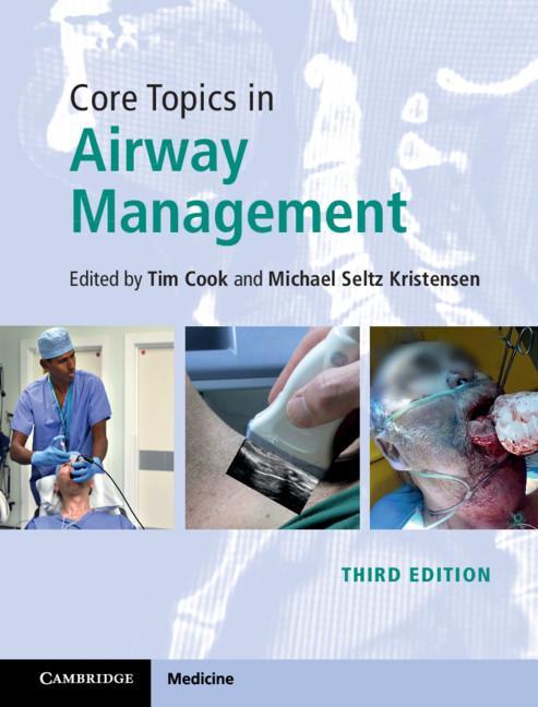 Carte Core Topics in Airway Management Michael Kristensen