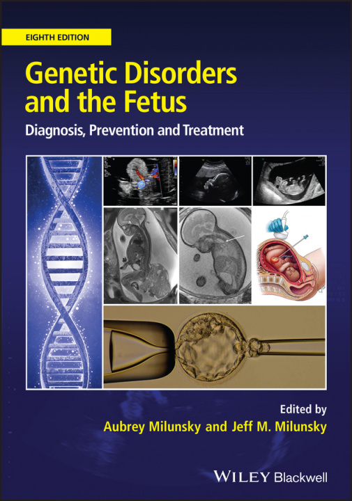 Knjiga Genetic Disorders and the Fetus - Diagnosis, Prevention and Treatment AUBREY MILUNSKY