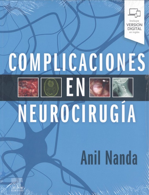 Книга Complicaciones en neurocirugía ANIL NANDA
