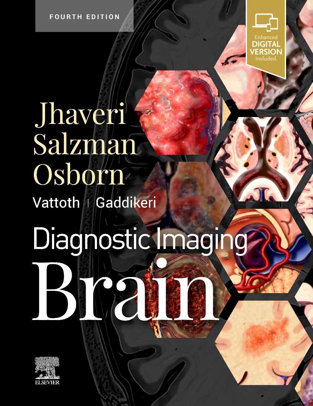 Könyv Diagnostic Imaging: Brain Miral D. Jhaveri
