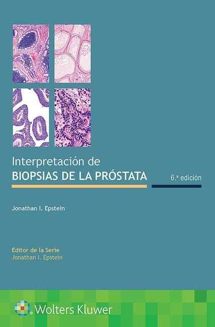 Book Interpretacion de biopsias de la prostata Epstein