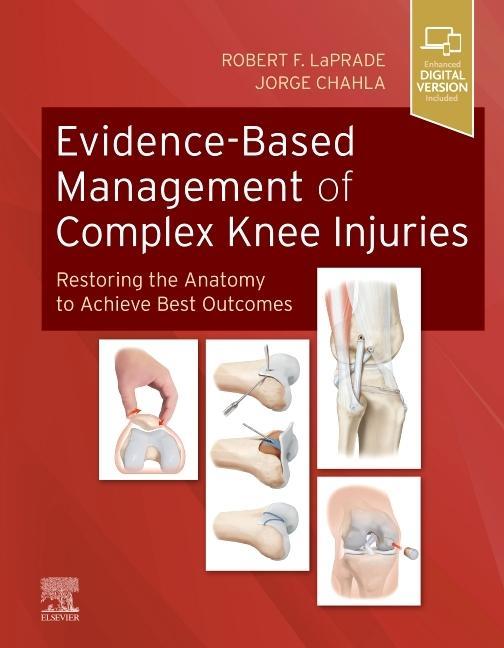 Kniha Evidence-Based Management of Complex Knee Injuries ROBERT F. LAPRADE