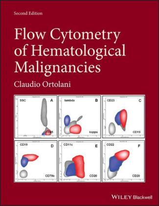 Книга Flow Cytometry of Hematological Malignancies 2nd Edition Claudio Ortolani