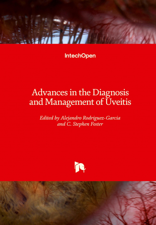 Kniha Advances in the Diagnosis and Management of Uveitis C. Stephen Foster