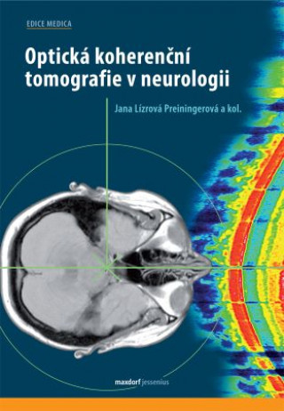 Kniha Optická koherenční tomografie v neurologii Jana Lízrová Preiningerová a kolektiv