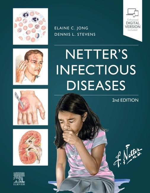 Книга Netter's Infectious Diseases 