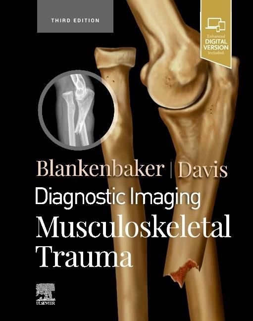Kniha Diagnostic Imaging: Musculoskeletal Trauma Blankenbaker