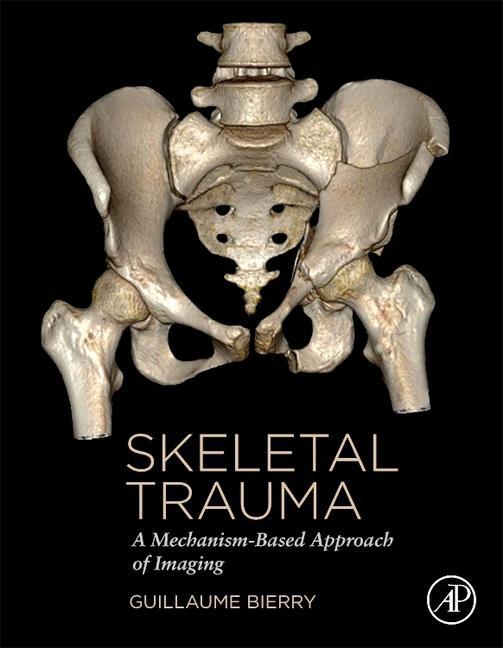 Kniha Skeletal Trauma 