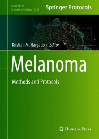 Könyv Melanoma 