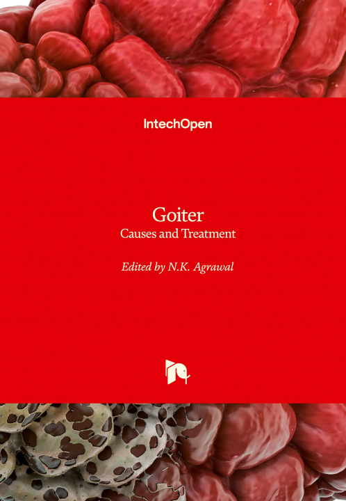 Buch Goiter N. K. Agrawal