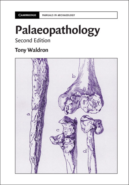 Könyv Palaeopathology Waldron Tony Waldron