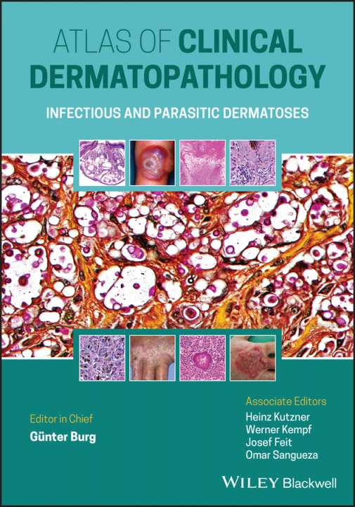 Book Atlas of Clinical Dermatopathology - Infectious and Parasitic Dermatoses GNTHER BURG