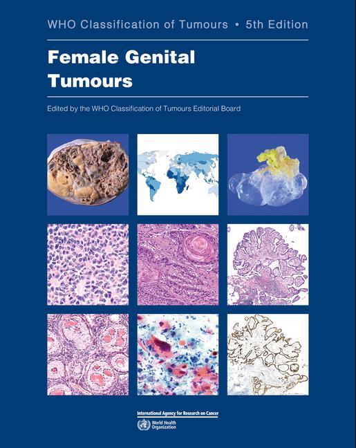 Knjiga Female Genital Tumours: Who Classification of Tumours 