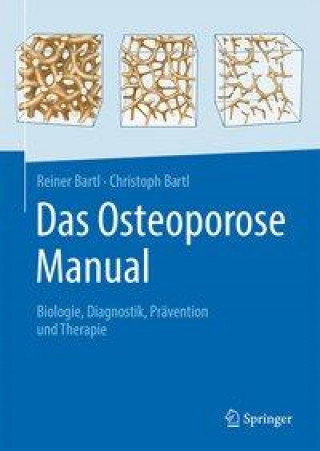 Kniha Das Osteoporose Manual Christoph Bartl