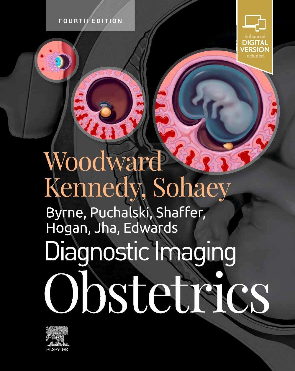 Kniha Diagnostic Imaging: Obstetrics Paula J. Woodward