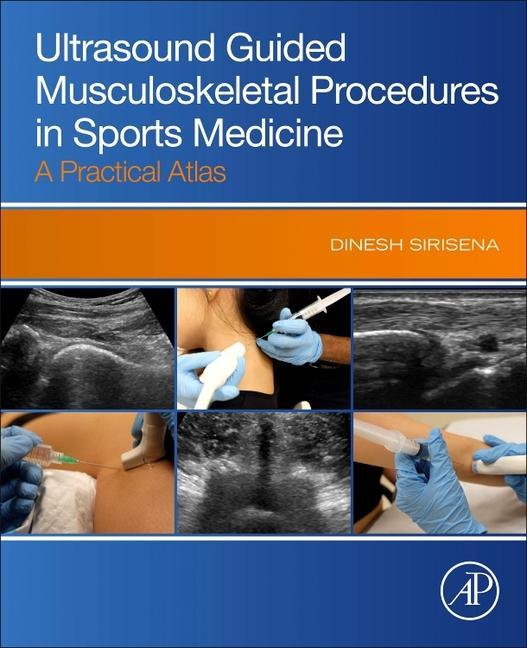 Carte Ultrasound Guided Musculoskeletal Procedures in Sports Medicine 
