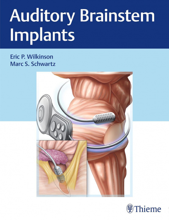 Knjiga Auditory Brainstem Implants Marc Schwartz