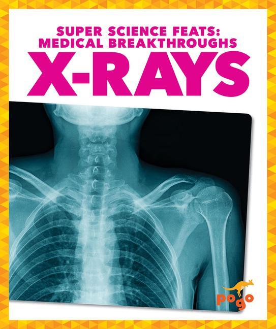 Knjiga X-Rays Alicia Z. Klepeis