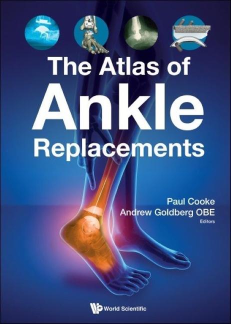Книга Atlas of Ankle Replacements Paul H. Cooke