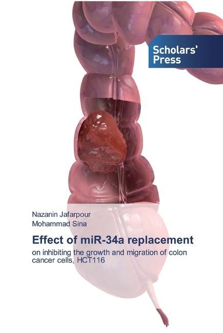 Knjiga Effect of miR-34a replacement Mohammad Sina