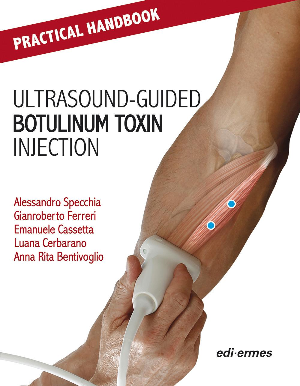 Book Practical Handbook for Ultrasound-guided Botulinum Toxin Injection 