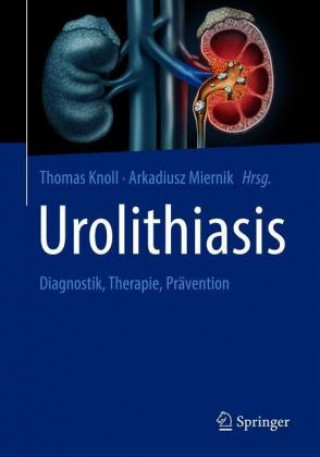 Könyv Urolithiasis Arkadiusz Miernik