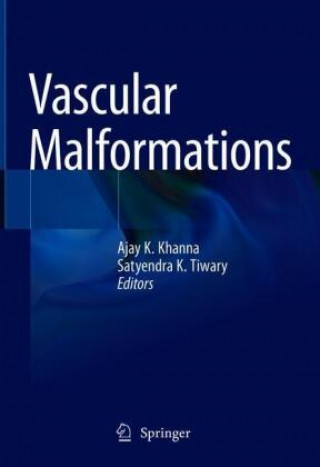 Kniha Vascular Malformations Satyendra K. Tiwary