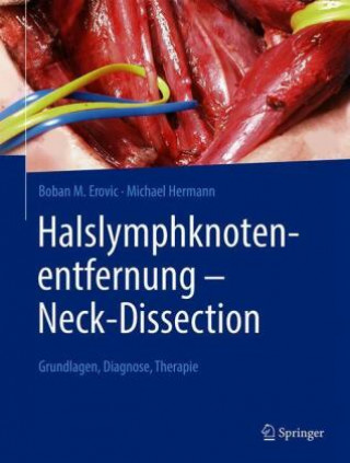 Книга Halslymphknotenentfernung - Neck-Dissection Michael Hermann
